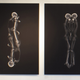 Illustration for article titled Cool X-Rays Show Couples Cuddling Like Youve Never Seen Them Before